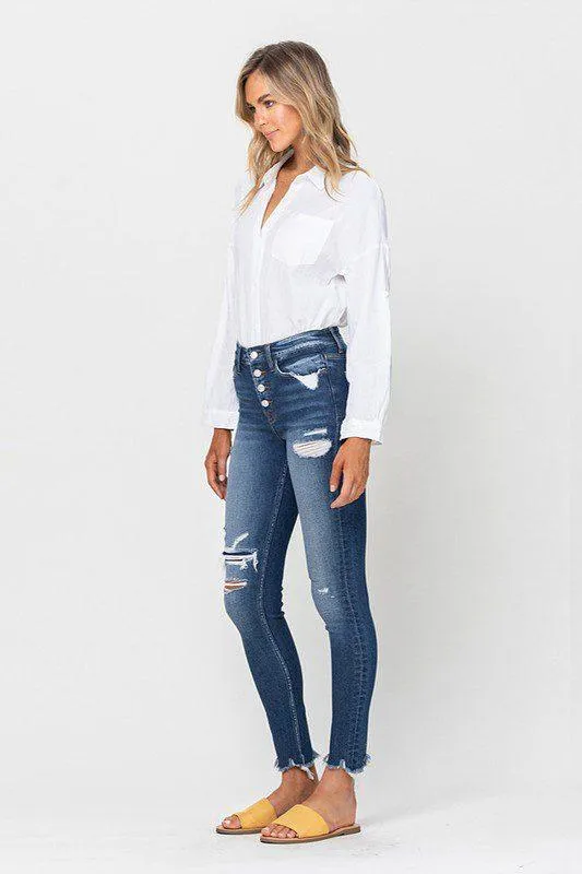 Vervet High Rise Patched Skinny Jeans