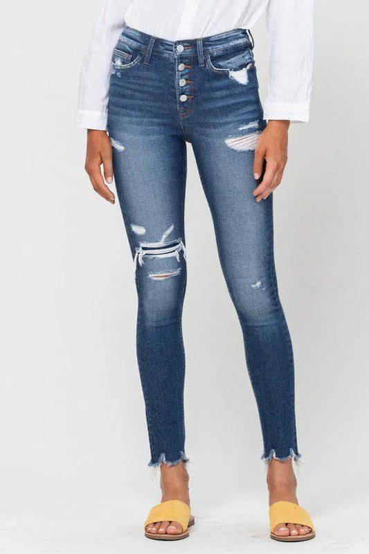 Vervet High Rise Patched Skinny Jeans