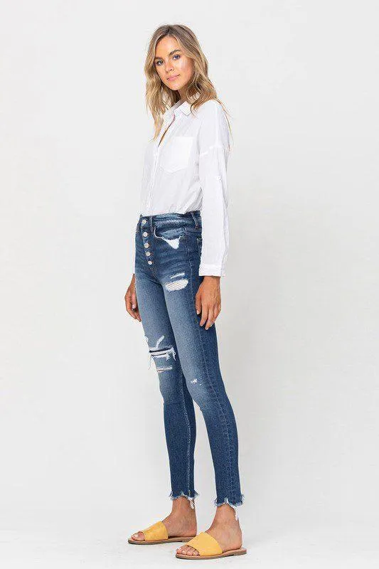 Vervet High Rise Patched Skinny Jeans