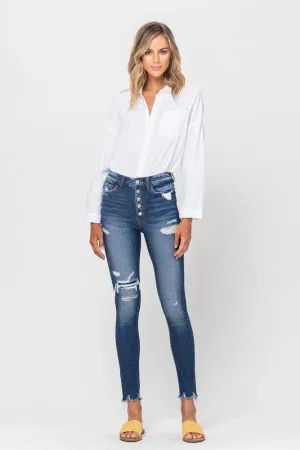Vervet High Rise Patched Skinny Jeans